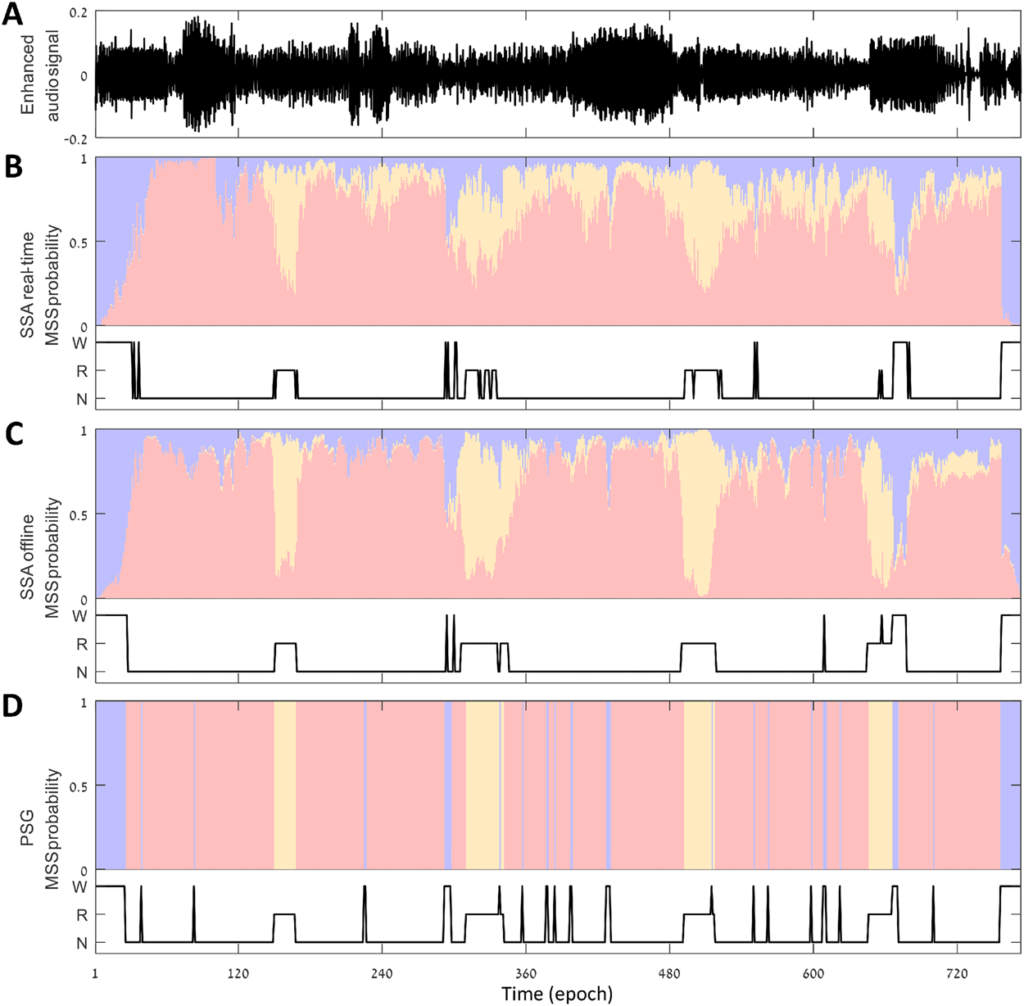 sleep study report