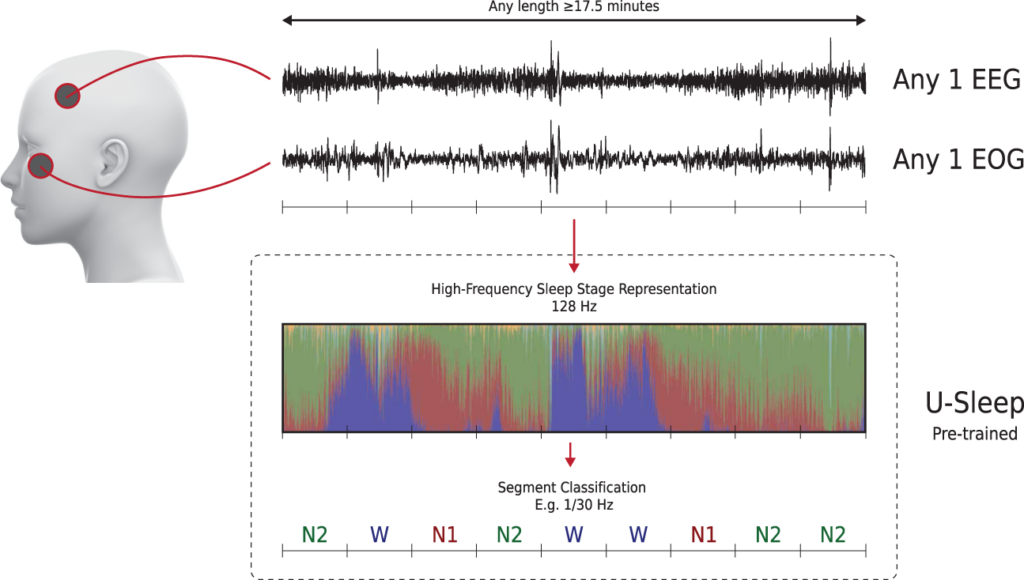 sleep study report